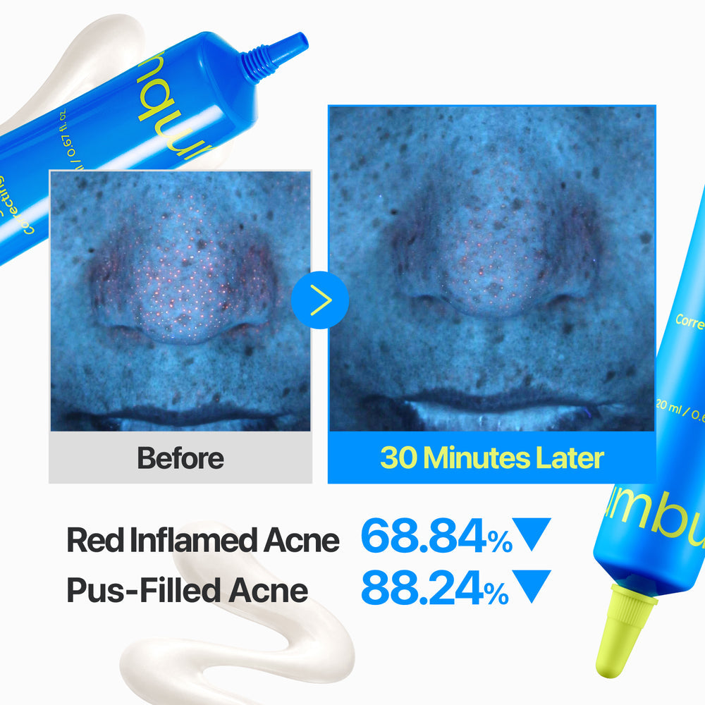 numbuzin Zero Blemish 3X crème correctrice ciblée 20ml