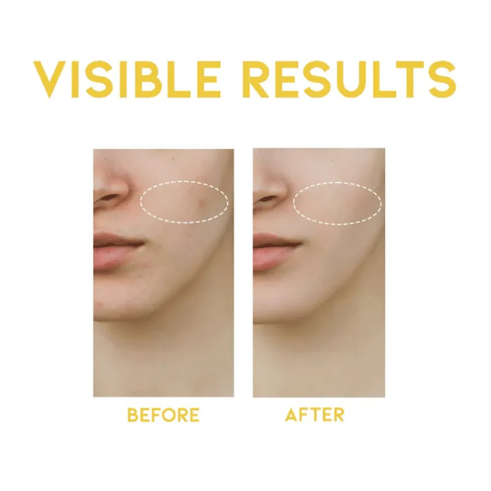 OOTD Dark Spot Vitamin C Serum 50ml by OOTD – Serum & Ampoule