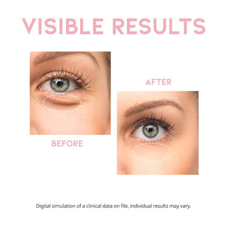 OOTD Depuff Eye Serum 30g by OOTD – Eye Cream & Serum