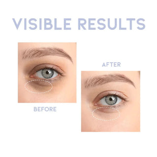 OOTD Intensive Eye Serum 30g by OOTD – Eye Cream & Serum