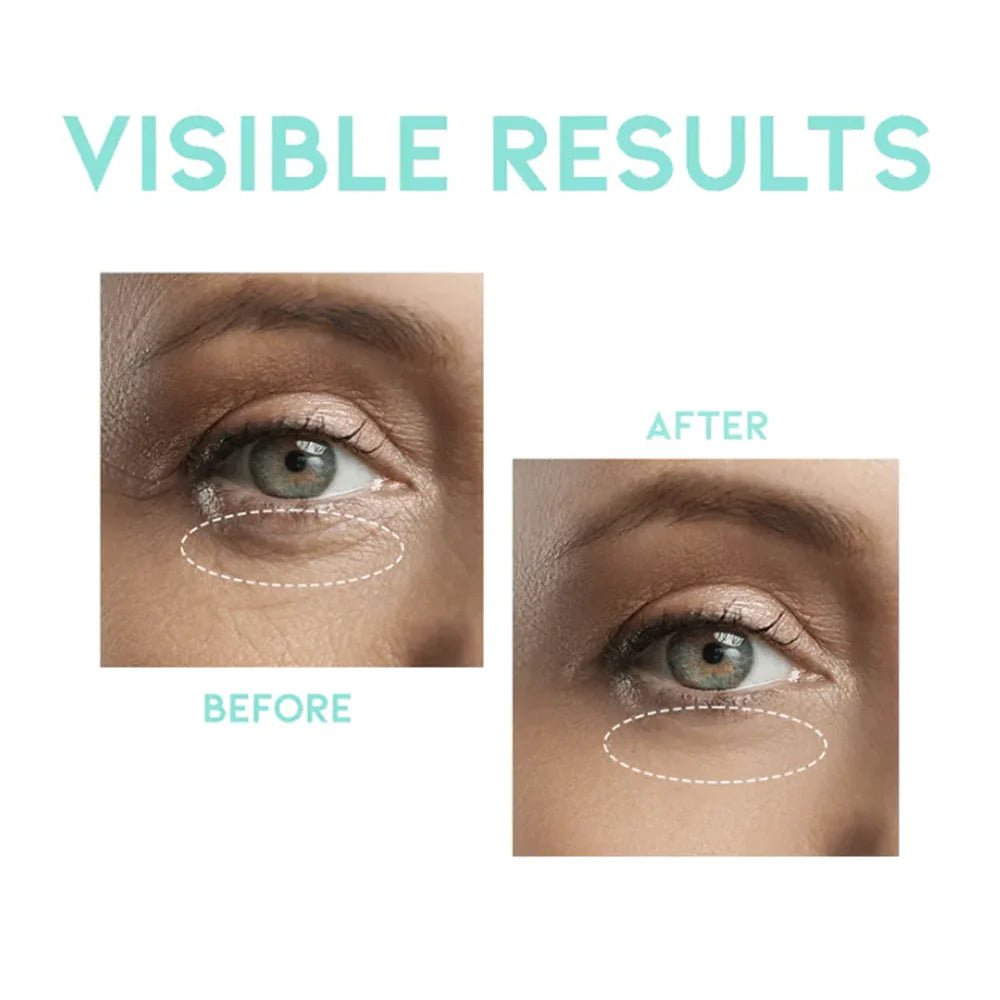 OOTD Wrinkle Lift Eye Serum 30g by OOTD – Eye Cream & Serum