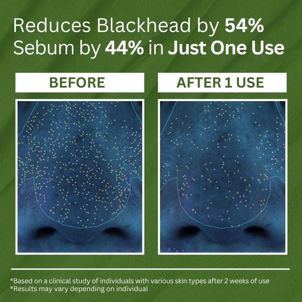 P.CALM Holy Basil Bubble Deep Mask 90g by P.CALM – Wash - Off Mask