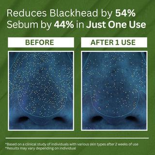 P.CALM Holy Basil Bubble Deep Mask 90g by P.CALM – Wash - Off Mask photo