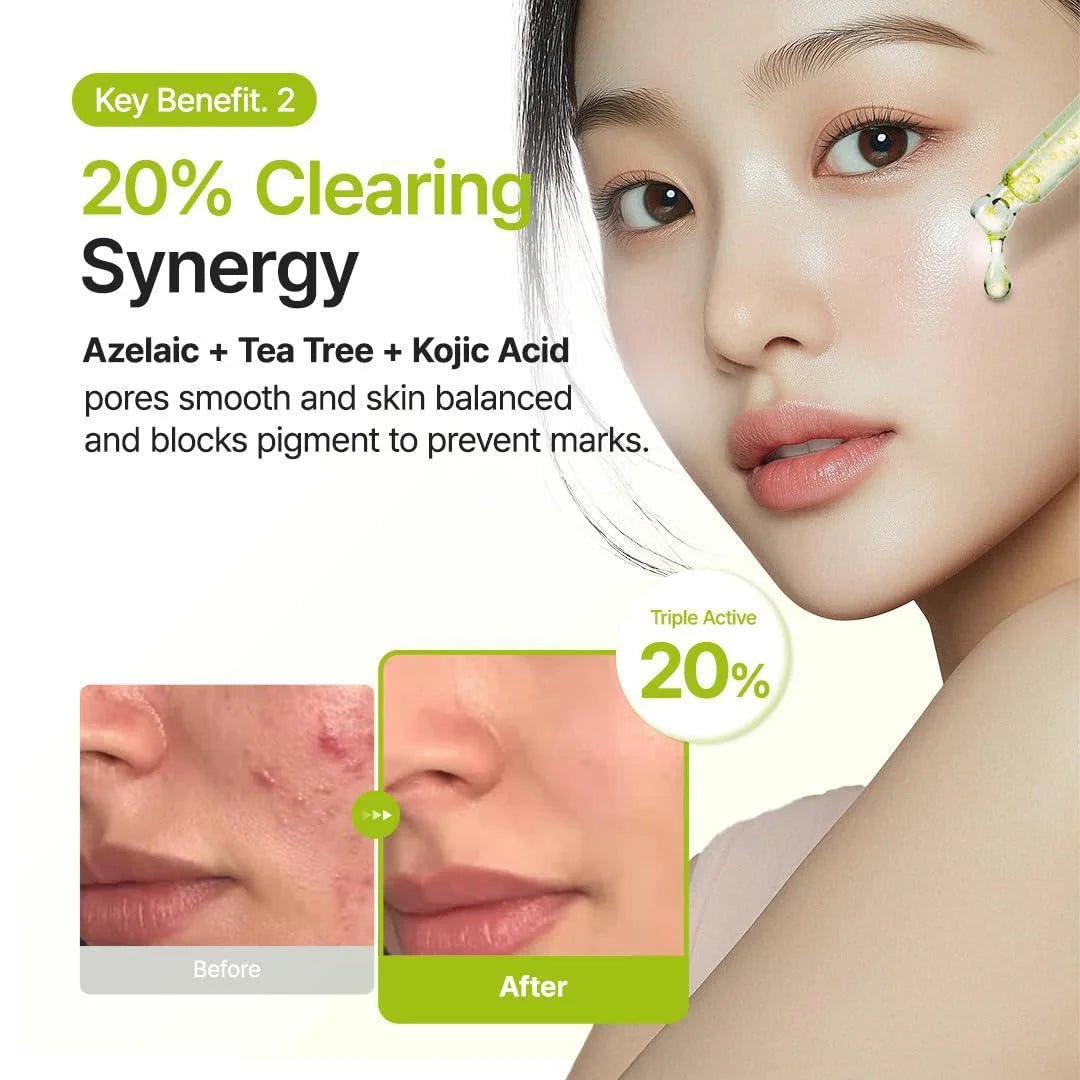 Purito Azelaic Acid 10 Kojic Tea Tree Serum 30ml by Purito – Serum & Ampoule