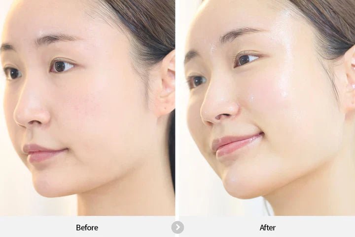 REJURAN Dual Effect Ampoule 30ml by REJURAN – Serum & Ampoule