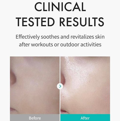REJURAN Skin Protection Mask (5 Pieces) by REJURAN – Sheet Mask
