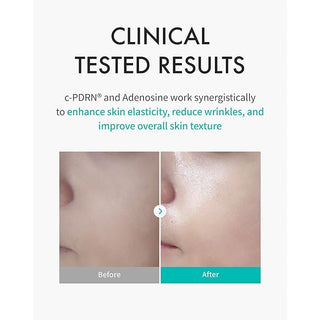 REJURAN Turnover Mask (5 Sheets) by REJURAN – Sheet Mask photo