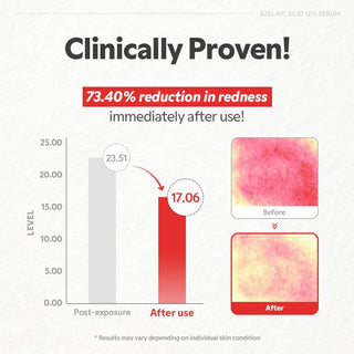 TIRTIR Azelaic Acid 12% Serum 30ml by TIRTIR – Serum & Ampoule photo