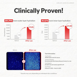 TIRTIR Azelaic Acid 12% Serum 30ml by TIRTIR – Serum & Ampoule photo