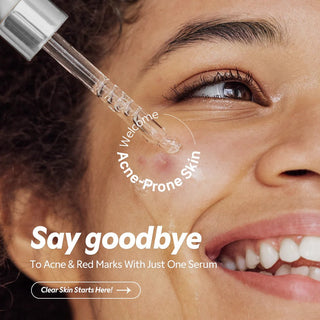 TIRTIR Azelaic Acid 12% Serum 30ml by TIRTIR – Serum & Ampoule photo