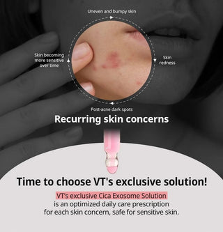 VT Azelaic A1 Calming Ampoule 30ml by VT Cosmetics – Serum & Ampoule photo