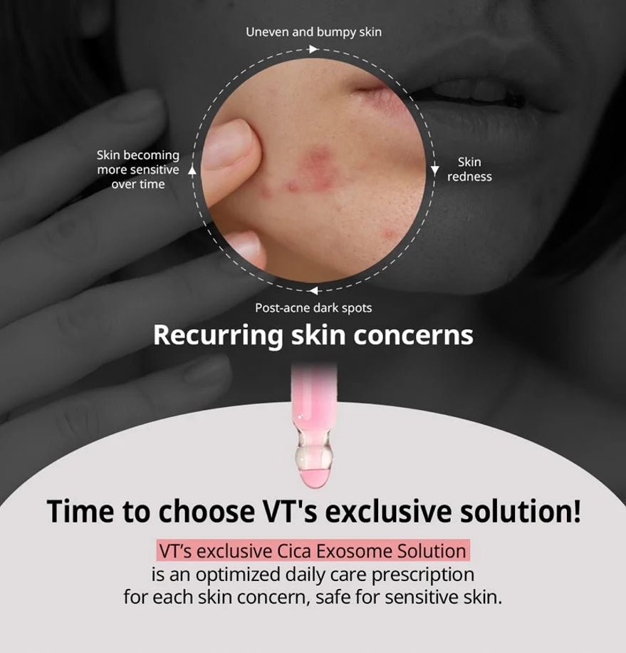 VT Azelaic A1 Calming Ampoule 30ml by VT Cosmetics – Serum & Ampoule