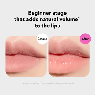 VT Reedle Shot Lip Plumper Beginner 4ml by VT Cosmetics – Lip Treatment photo