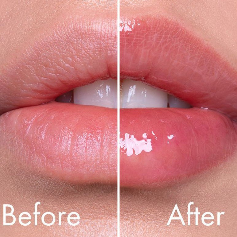 VT Reedle Shot Lip Plumper (Twinkle / Usagi Pink) 4.3g by VT Cosmetics – Lip Treatment