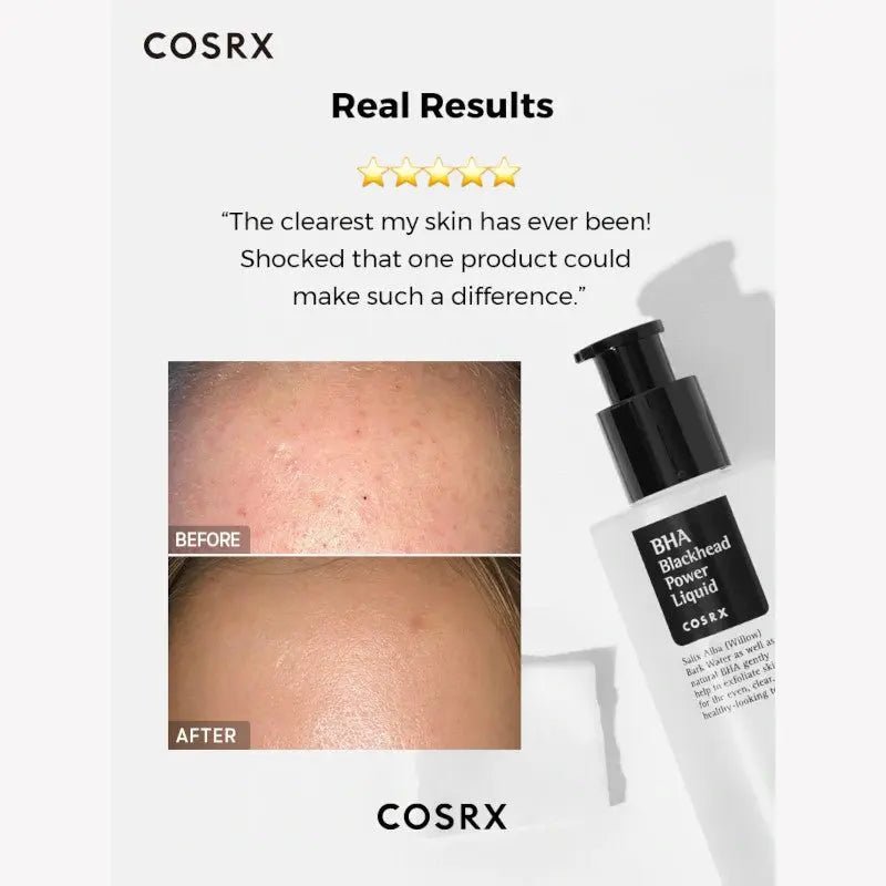 COSRX BHA Blackhead Power Liquid 100ml by COSRX – Toner & Essence
