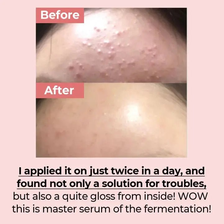 Numbuzin No.3 Skin Softening Serum 50ml by numbuzin – Serum & Ampoule